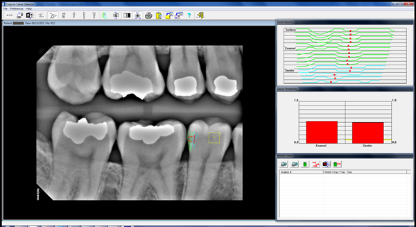 Cavity Detection Software - Red Scan